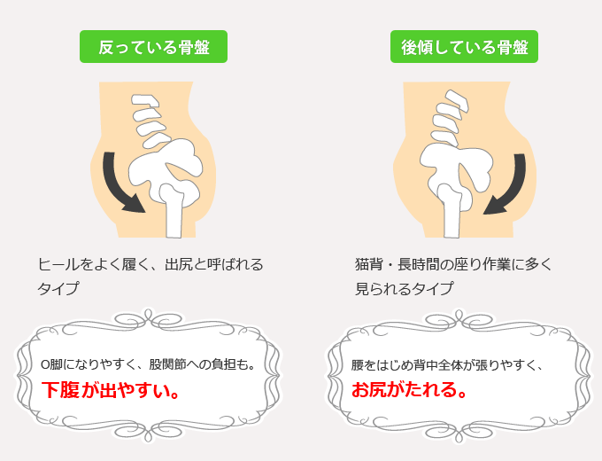 その他にも沿っている骨盤や後傾している骨盤などがあり、それぞれに悩みの症状が異なります。